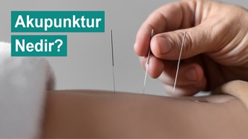 Akupunktur Tedavisi Nedir ?