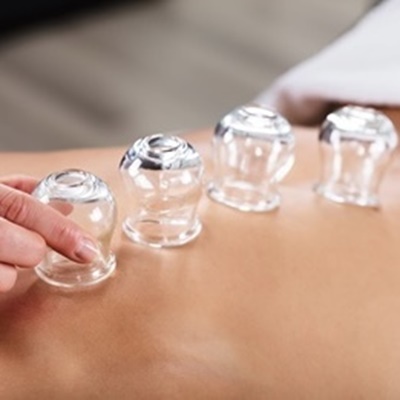 Medical Cupping Treatment