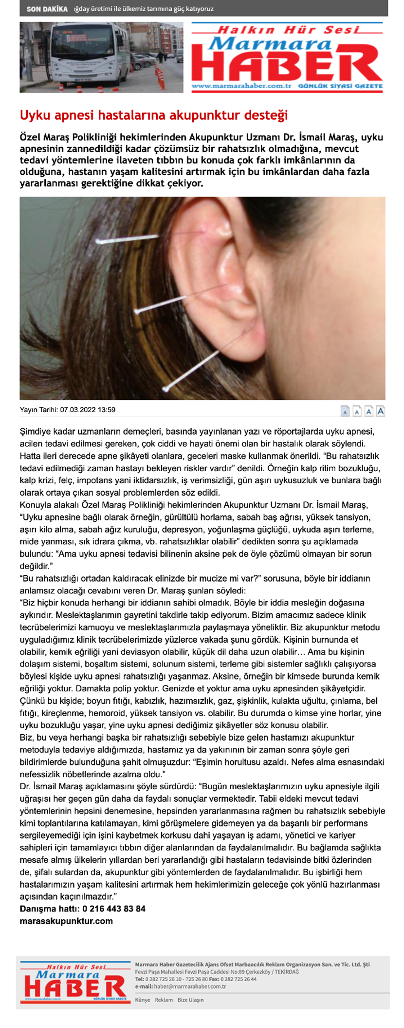 Uyku apnesi hastalarına akupunktur desteği - Marmara Haber Gazetesi
